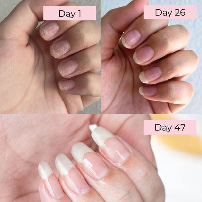 Olteria™ Nail Growth Pen